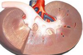 Обнаружены новые маркеры острого повреждения почек
