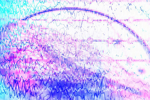 Новый метод поможет предсказать эпилептические приступы