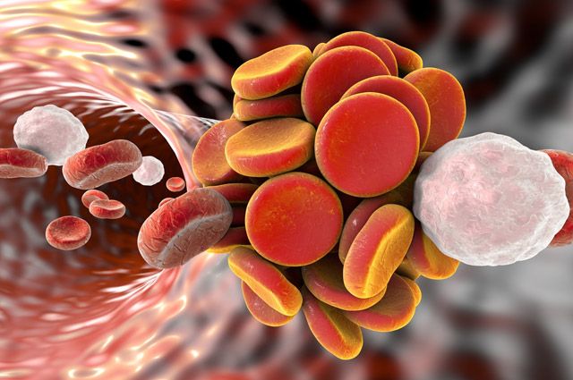 Уникальная система позволяет предотвратить образование тромбов