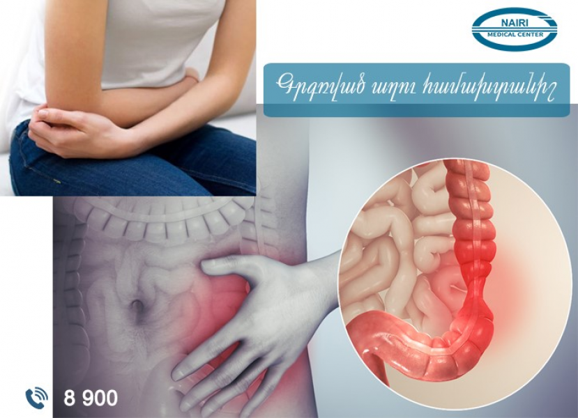 Синдром раздражённого кишечника. nairimed.com