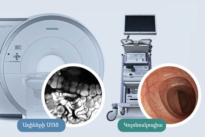 ՄՌՏ, թե՞ կոլոնոսկոպիա. armeniamedicalcenter.am