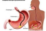 Гастроэнтерологическая служба: фиброгастроскопия