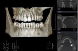 3D компьютерная томография в стоматологии