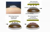 Группа ученых разработала пластырь для глаз с рассасывающимися иглами