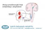 Проблемы с височно-нижнечелюстным суставом и депрессия