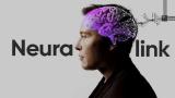 FDA одобрило операцию по имплантации мозгового чипа Neuralink второму пациенту