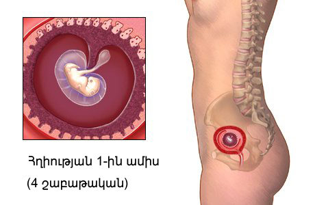 Հղիության առաջին ամիս (4 շաբաթական)