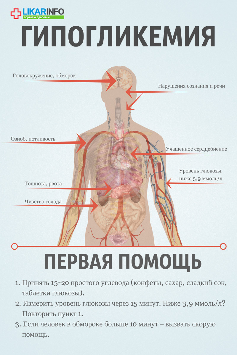 Гипогликемический обморок при диабете: что делать?