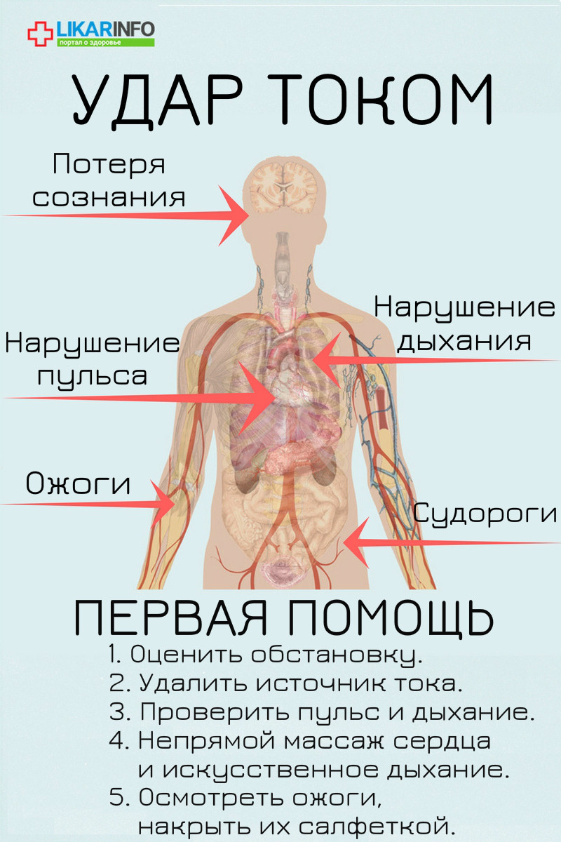 Электрический удар: первая помощь