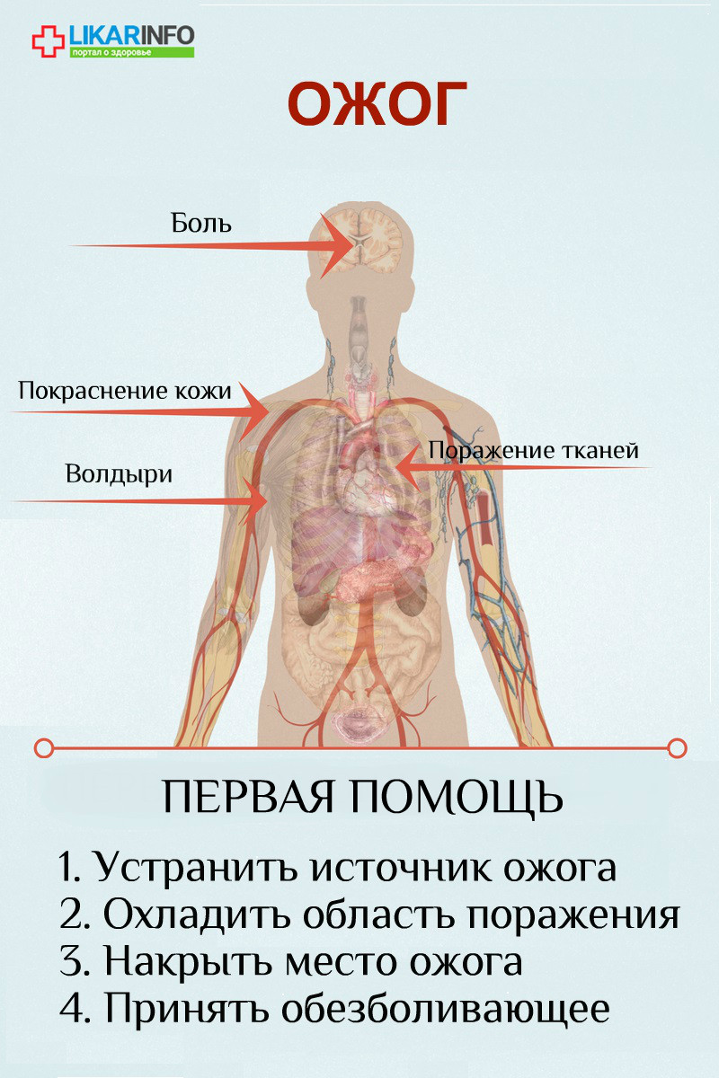 Первая помощь при ожогах