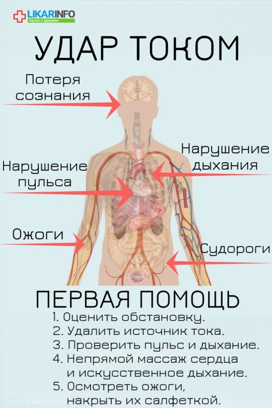 Удар током: первая помощь