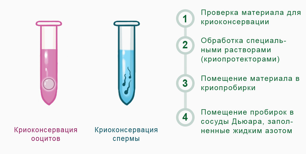 Криоконсервирование яйцеклеток и сперматозоидов