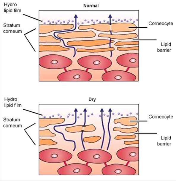 У сухой кожи влага постоянно испаряется
