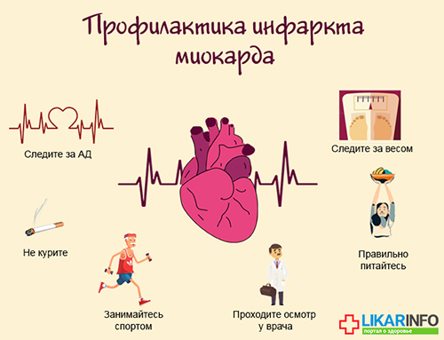 Инфаркт у женщин – атипичные